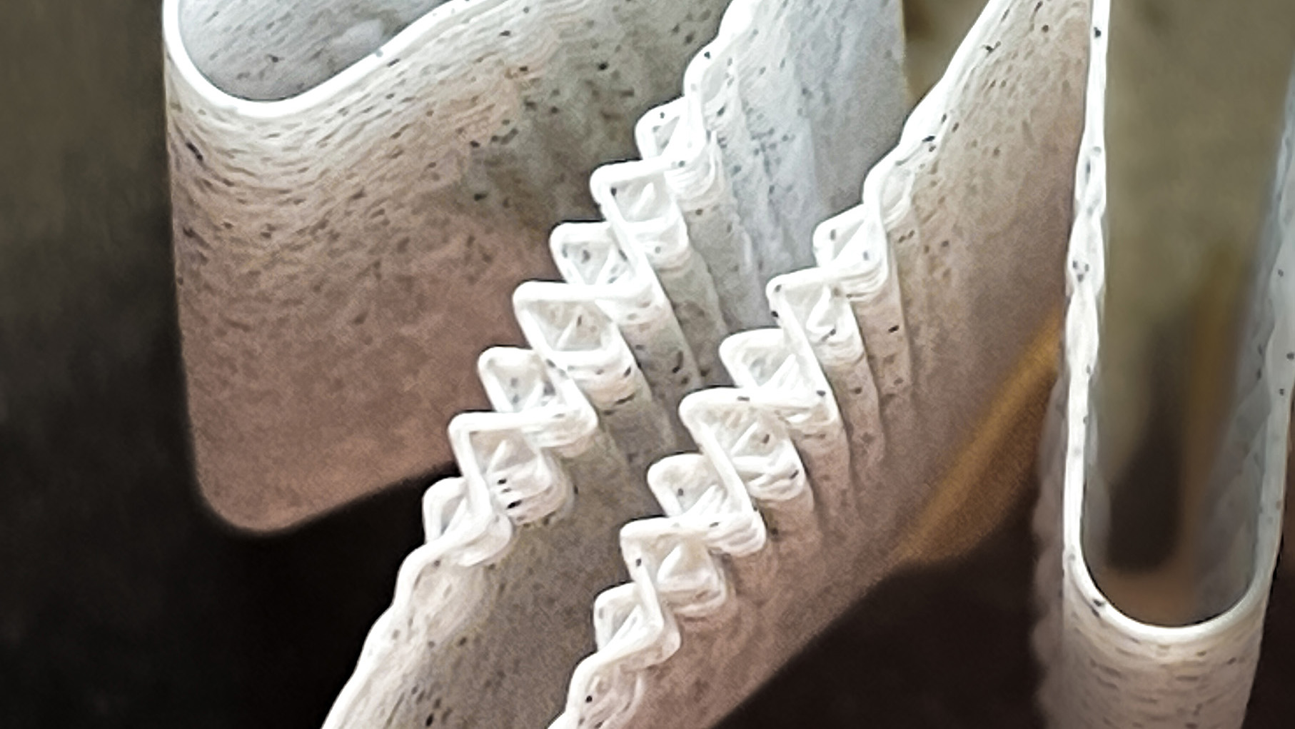 Material detail